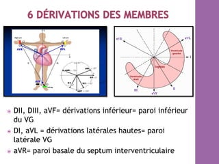 ⦿  DII, DIII, aVF= dérivations inférieur= paroi inférieur
du VG
⦿  DI, aVL = dérivations latérales hautes= paroi
latérale VG
⦿  aVR= paroi basale du septum interventriculaire
 