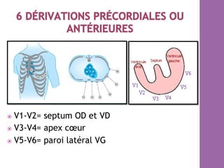 ⦿  V1-V2= septum OD et VD
⦿  V3-V4= apex cœur
⦿  V5-V6= paroi latéral VG
 