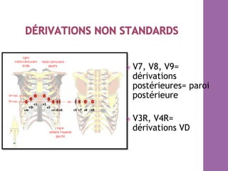 ⦿  V7, V8, V9=
dérivations
postérieures= paroi
postérieure
⦿  V3R, V4R=
dérivations VD
 