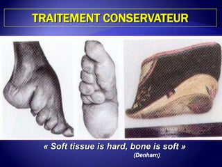 TRAITEMENT CONSERVATEUR
« Soft tissue is hard, bone is soft »
(Denham)
 