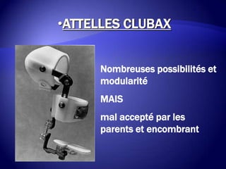 Nombreuses possibilités et
modularité
MAIS
mal accepté par les
parents et encombrant
•ATTELLES CLUBAX
 
