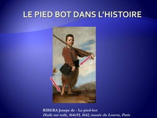 RIBERA Jusepe de - Le pied-bot
Huile sur toile, 164x93, 1642, musée du Louvre, Paris
 