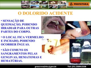 gveccvvs@rio.rj.gov.br Tel: (21) 2589-2338
O DOLORIDO ACIDENTE
• SENSAÇÃO DE
QUEIMAÇÃO, PODENDO
IRRADIAR PARA OUTRAS
PARTES DO CORPO.
• O LOCAL FICA VERMELHO
E INCHADO, PODENDO
OCORRER ÍNGUAS.
• SÃO COMUNS OS
SANGRAMENTOS PELAS
GENGIVAS, HEMATOMAS E
HEMATÚRIAS.
 