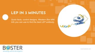 www.bosterbio.com
LEP IN 3 MINUTES
Quick facts, control designs, Western Blot MW.
Info you can use to find the best LEP antibody.
 