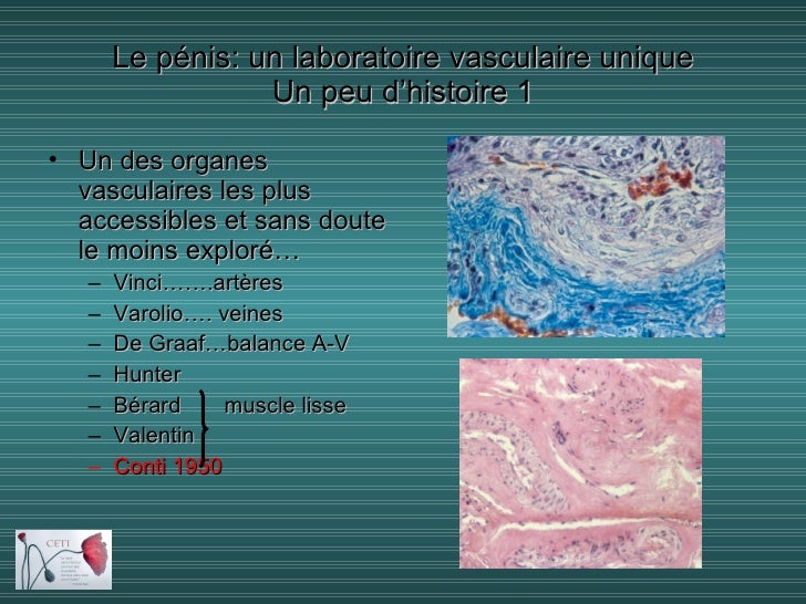 Le pénis