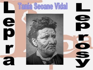 Leprosy Lepra Tania Seoane Vidal 
