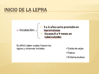 INICIO DE LA LEPRA
 