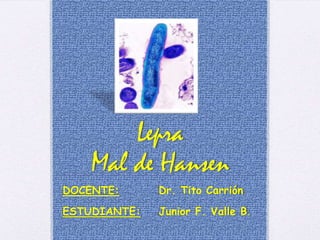 DOCENTE: Dr. Tito Carrión
ESTUDIANTE: Junior F. Valle B.
Lepra
Mal de Hansen
 