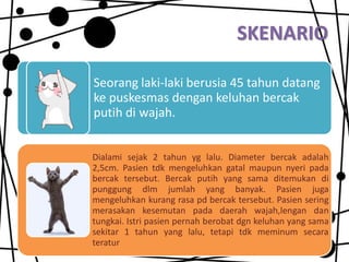 SKENARIO
Seorang laki-laki berusia 45 tahun datang
ke puskesmas dengan keluhan bercak
putih di wajah.
Dialami sejak 2 tahun yg lalu. Diameter bercak adalah
2,5cm. Pasien tdk mengeluhkan gatal maupun nyeri pada
bercak tersebut. Bercak putih yang sama ditemukan di
punggung dlm jumlah yang banyak. Pasien juga
mengeluhkan kurang rasa pd bercak tersebut. Pasien sering
merasakan kesemutan pada daerah wajah,lengan dan
tungkai. Istri pasien pernah berobat dgn keluhan yang sama
sekitar 1 tahun yang lalu, tetapi tdk meminum secara
teratur

 