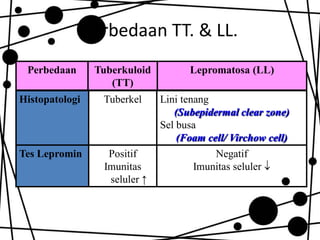 Perbedaan TT. & LL.
Perbedaan

Tuberkuloid
(TT)

Histopatologi

Tuberkel

Tes Lepromin

Positif
Imunitas
seluler ↑

Lepromatosa (LL)
Lini tenang
(Subepidermal clear zone)
Sel busa
(Foam cell/ Virchow cell)
Negatif
Imunitas seluler 

 