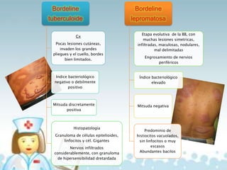 Bordeline

Bordeline

tuberculoide

lepromatosa

Cx
Pocas lesiones cutáneas,
invaden los grandes
pliegues y el cuello, bordes
bien limitados.

Indice bacteriológico
negativo o debilmente
positivo

Mitsuda discretamente
positiva

Histopatología
Granuloma de células epitelioides,
linfocitos y cél. Gigantes
Nervios infiltrados
considerablemente, con granuloma
de hipersensibilidad dretardada

Etapa evolutiva de la BB, con
muchas lesiones simetricas,
infiltradas, maculosas, nodulares,
mal delimitadas
Engrosamiento de nervios
periféricos

Índice bacteriológico
elevado

Mitsuda negativa

Predominio de
histiocitos vacuolados,
sin linfocitos o muy
escasos
Abundantes bacilos

 