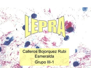 Calleros Bojorquez Rubi
Esmeralda
Grupo III-1
 