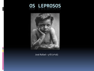OS LEPROSOS
José Rafael – 5ºD (nº16)
 