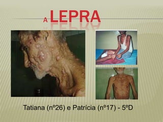 A   LEPRA



Tatiana (nº26) e Patrícia (nº17) - 5ºD
 