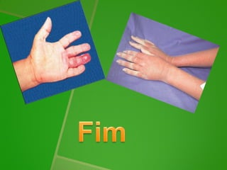 Lepra 5 e9joãopaulo