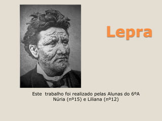 Lepra


Este trabalho foi realizado pelas Alunas do 6ºA
         Núria (nº15) e Liliana (nº12)
 
