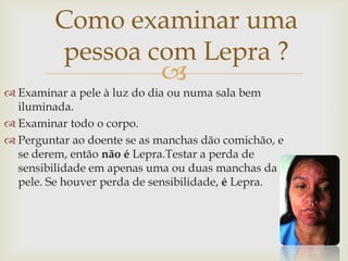 Como examinar uma
         pessoa com Lepra ?
                 
 Examinar a pele à luz do dia ou numa sala bem
  iluminada.
 Examinar todo o corpo.
 Perguntar ao doente se as manchas dão comichão, e
  se derem, então não é Lepra.Testar a perda de
  sensibilidade em apenas uma ou duas manchas da
  pele. Se houver perda de sensibilidade, é Lepra.
 