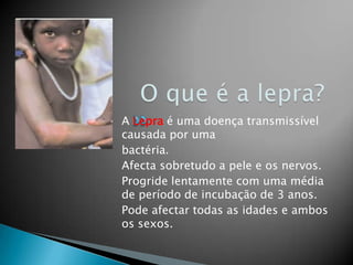 A Lepra é uma doença transmissível
causada por uma
bactéria.
Afecta sobretudo a pele e os nervos.
Progride lentamente com uma média
de período de incubação de 3 anos.
Pode afectar todas as idades e ambos
os sexos.
 