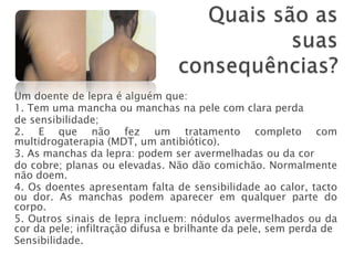 Um doente de lepra é alguém que:
1. Tem uma mancha ou manchas na pele com clara perda
de sensibilidade;
2. E que não fez um tratamento completo com
multidrogaterapia (MDT, um antibiótico).
3. As manchas da lepra: podem ser avermelhadas ou da cor
do cobre; planas ou elevadas. Não dão comichão. Normalmente
não doem.
4. Os doentes apresentam falta de sensibilidade ao calor, tacto
ou dor. As manchas podem aparecer em qualquer parte do
corpo.
5. Outros sinais de lepra incluem: nódulos avermelhados ou da
cor da pele; infiltração difusa e brilhante da pele, sem perda de
Sensibilidade.
 