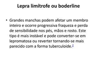 Lepra limítrofe ou boderline
• Grandes manchas podem afetar um membro
inteiro e ocorre progressiva fraqueza e perda
de sensibilidade nos pés, mãos e rosto. Este
tipo é mais instável e pode converter-se em
lepromatosa ou reverter tornando-se mais
parecido com a forma tuberculoide.2
 