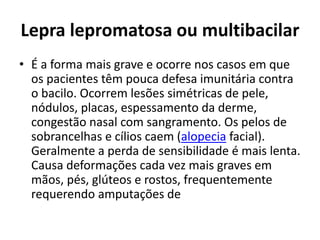 Lepra lepromatosa ou multibacilar
• É a forma mais grave e ocorre nos casos em que
os pacientes têm pouca defesa imunitária contra
o bacilo. Ocorrem lesões simétricas de pele,
nódulos, placas, espessamento da derme,
congestão nasal com sangramento. Os pelos de
sobrancelhas e cílios caem (alopecia facial).
Geralmente a perda de sensibilidade é mais lenta.
Causa deformações cada vez mais graves em
mãos, pés, glúteos e rostos, frequentemente
requerendo amputações de
 