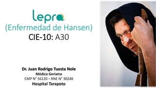 (Enfermedad de Hansen)
CIE-10: A30
Dr. Juan Rodrigo Tuesta Nole
Médico Geriatra
CMP N° 56120 – RNE N° 30248
Hospital Tarapoto
 