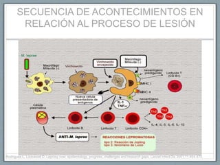 SECUENCIA DE ACONTECIMIENTOS EN
RELACIÓN AL PROCESO DE LESIÓN
Rodríguez L, Lockwood D. Leprosy now: epidemiology, progress, challenges and research gaps. Lancet Infect Dis 2001;11:464-470.
 