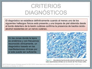 CRITERIOS
DIAGNÓSTICOS
El diagnóstico se establece definitivamente cuando al menos uno de los
siguientes hallazgos físicos está presente y una biopsia de piel obtenida desde
el borde delantero de la lesión cutánea confirma la presencia de bacilos ácido-
alcohol resistentes en un nervio cutáneo.
En las zonas donde la lepra
es endémica y con frecuencia
reconocido clínicamente, un
diagnóstico basado en las
manifestaciones clínicas por
sí sola puede ser suficiente.
WHO Global Leprosy Strategy agreed for 2011-2015. www.searo.who.int/EN/Section980/Section2572/Section2578_14961.htm
(Accessed on October 12, 2011).
 