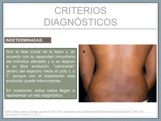 CRITERIOS
DIAGNÓSTICOS
Son la fase inicial de la lepra y, de
acuerdo con la capacidad inmunitaria
del individuo afectado y si se dejaran
a su libre evolución, “caminarán”
dentro del espectro hacia el polo L o
T; aunque con el tratamiento esta
evolución puede interrumpirse.
En ocasiones, estos casos llegan a
representar un reto diagnóstico.
INDETERMINADAS:
WHO Global Leprosy Strategy agreed for 2011-2015. www.searo.who.int/EN/Section980/Section2572/Section2578_14961.htm
(Accessed on October 12, 2011).
 