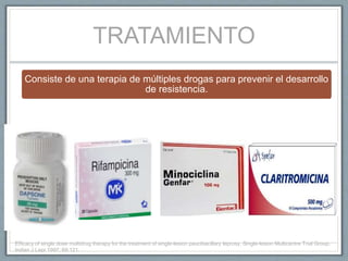 TRATAMIENTO
Consiste de una terapia de múltiples drogas para prevenir el desarrollo
de resistencia.
Efficacy of single dose multidrug therapy for the treatment of single-lesion paucibacillary leprosy. Single-lesion Multicentre Trial Group.
Indian J Lepr 1997; 69:121.
 