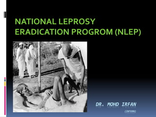 DR. MOHD IRFAN
(INTERN)
NATIONAL LEPROSY
ERADICATION PROGROM (NLEP)
 