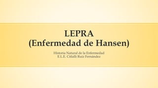 LEPRA
(Enfermedad de Hansen)
Historia Natural de la Enfermedad
E.L.E. Citlalli Ruíz Fernández
 