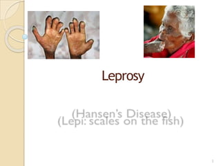 1
Leprosy
 