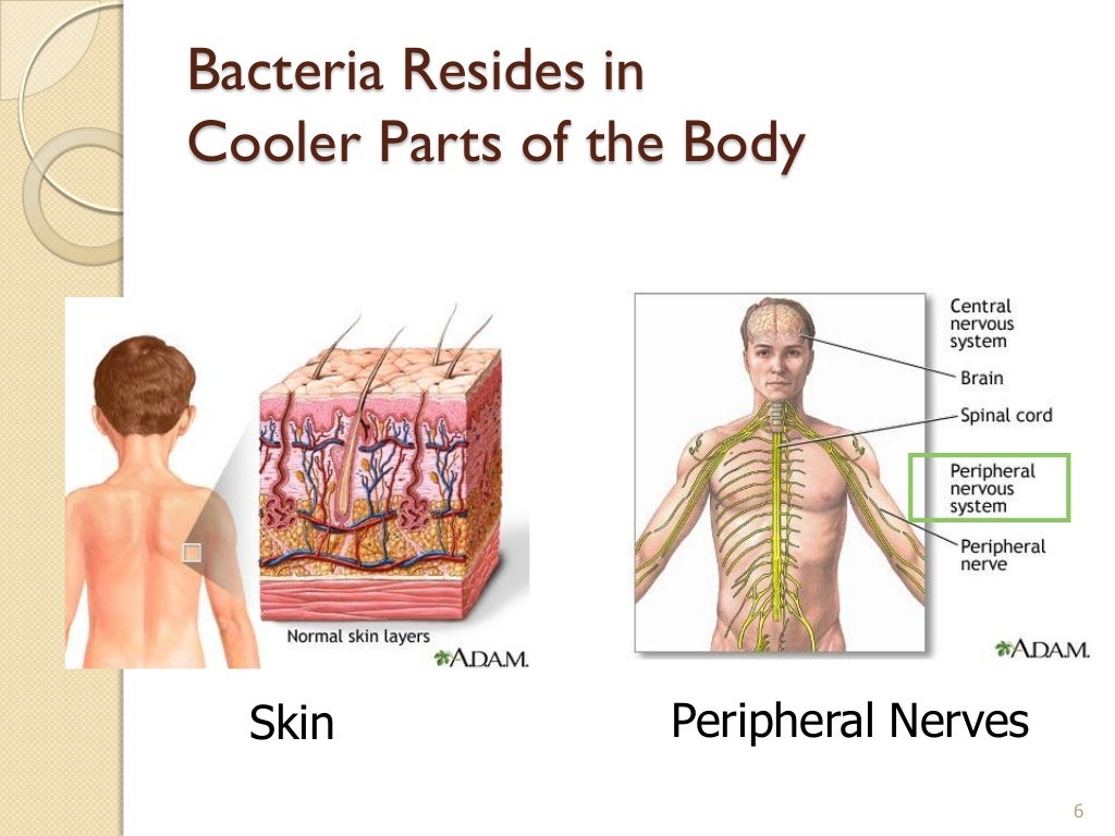 Pathophysiology of Leprosy