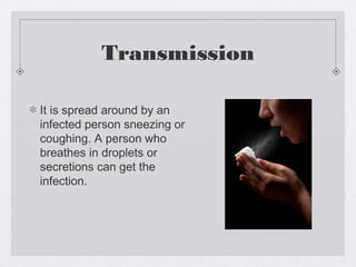 Transmission
It is spread around by an
infected person sneezing or
coughing. A person who
breathes in droplets or
secretions can get the
infection.