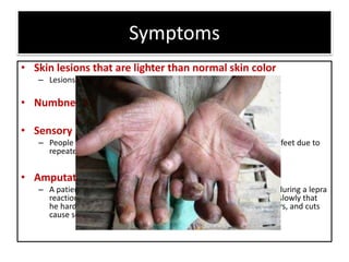 Symptoms
• Skin lesions that are lighter than normal skin color
– Lesions have decreased sensation to touch, heat, or pain
• Numbness
• Sensory loss
– People with long-term leprosy may lose the use of their hands or feet due to
repeated injury because they lack feeling in those areas.
• Amputation
– A patient with leprosy can lose the feeling in his hands suddenly during a lepra
reaction, so that he complains of an immediate numbness, or so slowly that
he hardly notices it. When this happens, neglected bruises, blisters, and cuts
cause scars that progressively destroy the pulps of his fingers.
 