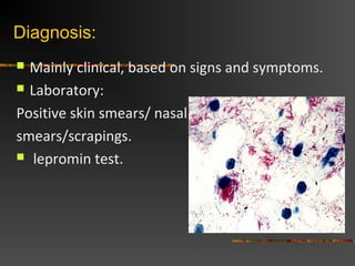 Diagnosis:
Mainly clinical, based on signs and symptoms.
Laboratory:
Positive skin smears/ nasal
smears/scrapings.
lepromin test.