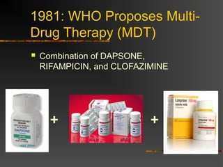 1981: WHO Proposes Multi-
Drug Therapy (MDT)
Combination of DAPSONE,
RIFAMPICIN, and CLOFAZIMINE
+ +