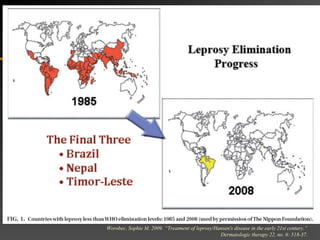 Worobec, Sophie M. 2009. “Treatment of leprosy/Hansen's disease in the early 21st century.”
Dermatologic therapy 22, no. 6: 518-37.