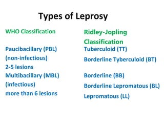 WHO Classification Ridley-Jopling
Classification
Paucibacillary (PBL)
(non-infectious)
2-5 lesions
Tuberculoid (TT)
Borderline Tyberculoid (BT)
Multibacillary (MBL)
(infectious)
more than 6 lesions
Borderline (BB)
Borderline Lepromatous (BL)
Lepromatous (LL)
Types of Leprosy
 