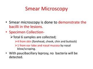 Smear Microscopy
• Smear microscopy is done to demonstrate the
bacilli in the lesions.
• Specimen Collection-
Total 6 samples are collected;
4 from skin (forehead, cheek, chin and buttock)
1 from ear lobe and nasal mucosa by nasal
blow/scraping.
• With paucibacillary leprosy, no bacteria will be
detected.
 