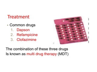 Treatment
• Common drugs
1. Dapson
2. Refampicine
3. Clofazimine
The combination of these three drugs
Is known as multi drug therapy (MDT)
 