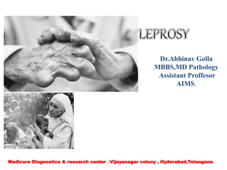 Dr.Abhinav Golla
MBBS,MD Pathology
Assistant Proffesor
AIMS.
Medicure Diagnostics & research center , Vijayanagar colony , Hyderabad,Telangana.
 
