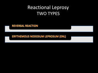 Reactional Leprosy
TWO TYPES
 