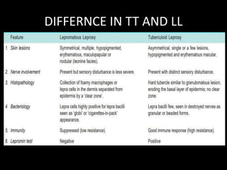 DIFFERNCE IN TT AND LL
 