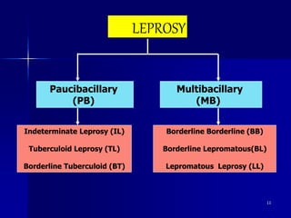 LEPROSY
Paucibacillary
(PB)
Multibacillary
(MB)
Indeterminate Leprosy (IL)
Tuberculoid Leprosy (TL)
Borderline Tuberculoid (BT)
Borderline Borderline (BB)
Borderline Lepromatous(BL)
Lepromatous Leprosy (LL)
11
 