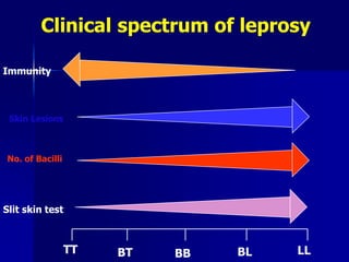 TT BT BB BL LL
Skin Lesions
No. of Bacilli
Slit skin test
Immunity
Clinical spectrum of leprosy
 