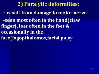 2) Paralytic deformities:
- result from damage to motor nerve.
-seen most often in the hand(claw
finger), less often in the feet &
occasionally in the
face(lagopthalomos,facial palsy
46
 