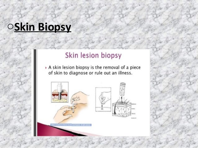 an overview of leprosy Overview of victorian britain the powerpoint ppt presentation: what is leprosy is the property of its rightful owner do you have powerpoint slides to share. an overview of leprosy Overview of victorian britain the powerpoint ppt presentation: what is leprosy is the property of its rightful owner do you have powerpoint slides to share.