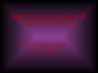 HISTOPATHOGENESIS OF
HANSEN’S DISEASE
BY:Dr. RASHMI SINGH
JR-1 ,SKIN&VD
 